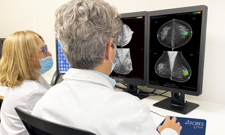 Mamografia Ascires